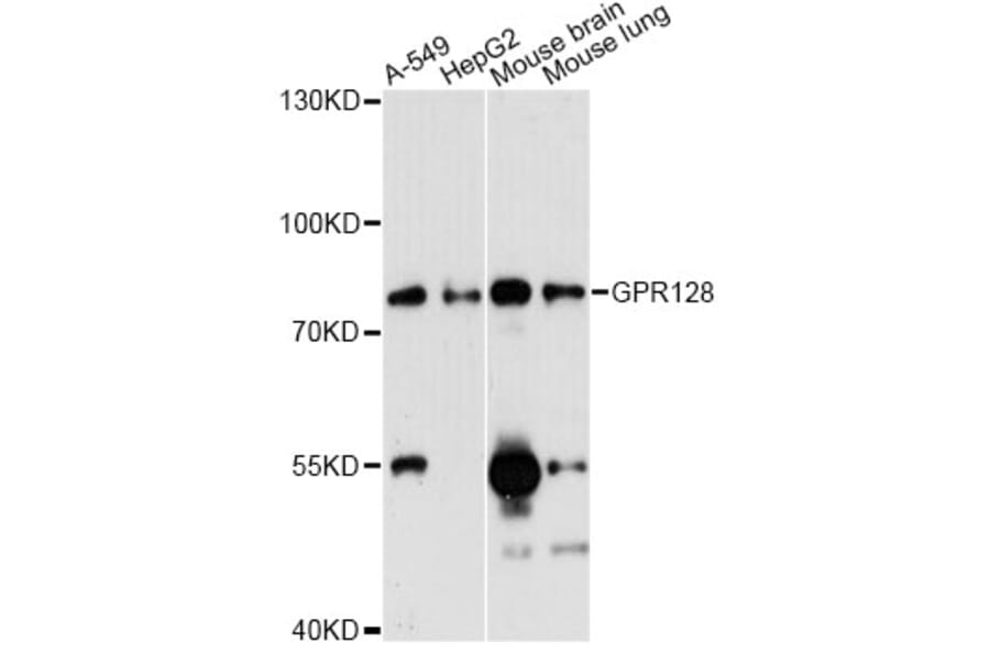 Western Blot - Anti-GPR128 Antibody (A14431) - Antibodies.com