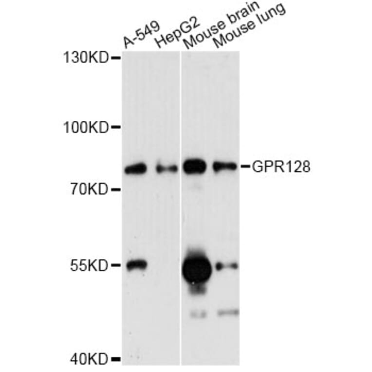 Western Blot - Anti-GPR128 Antibody (A14431) - Antibodies.com