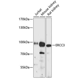 Western Blot - Anti-XPB Antibody (A91393) - Antibodies.com
