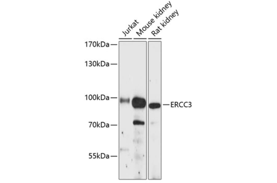 Western Blot - Anti-XPB Antibody (A91393) - Antibodies.com