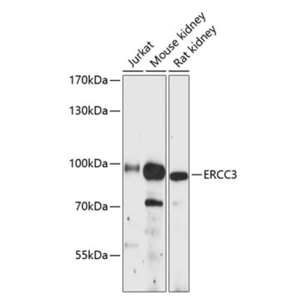 Western Blot - Anti-XPB Antibody (A91393) - Antibodies.com