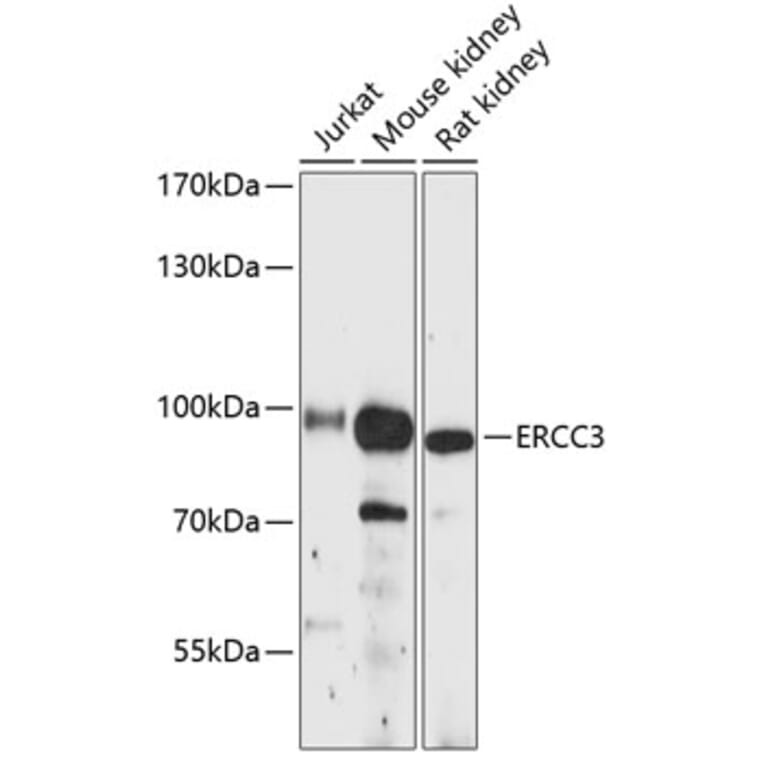 Western Blot - Anti-XPB Antibody (A91393) - Antibodies.com