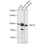 Western Blot - Anti-XPB Antibody (A91393) - Antibodies.com