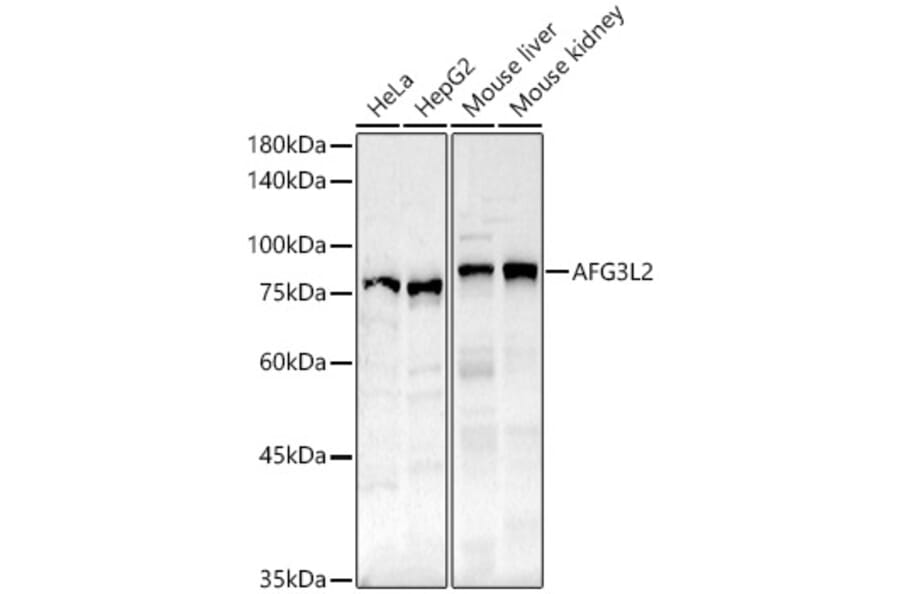 Western Blot - Anti-AFG3L2 Antibody (A91394) - Antibodies.com