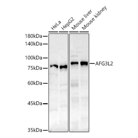 Western Blot - Anti-AFG3L2 Antibody (A91394) - Antibodies.com