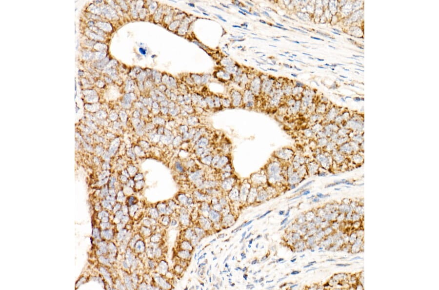 Immunohistochemistry - Anti-AFG3L2 Antibody (A91394) - Antibodies.com