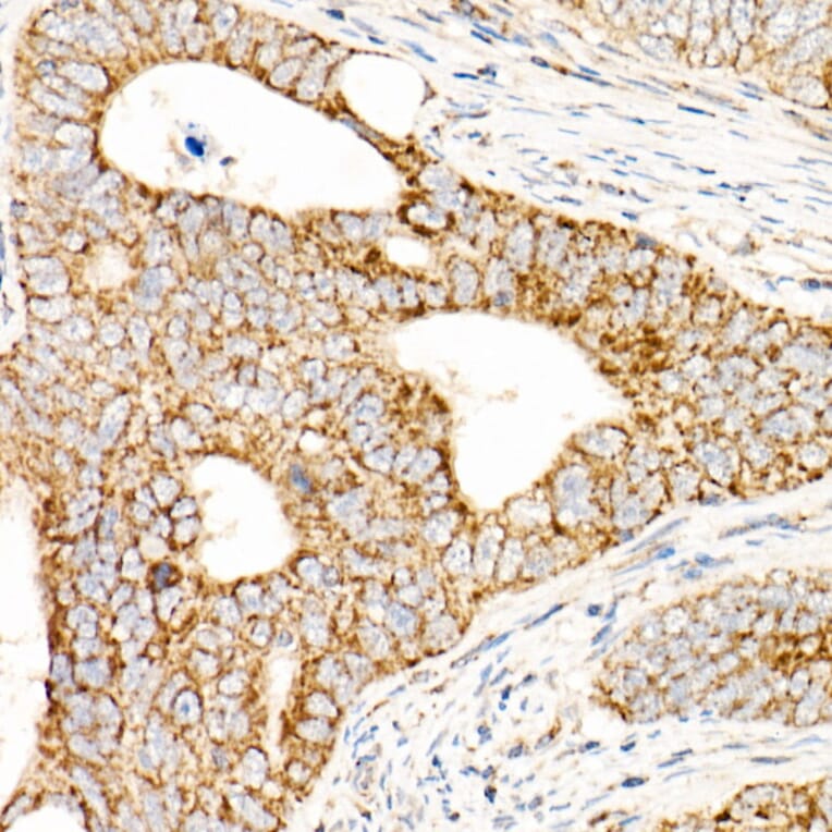 Immunohistochemistry - Anti-AFG3L2 Antibody (A91394) - Antibodies.com