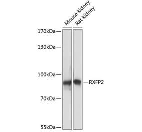 Western Blot - Anti-RXFP2 Antibody (A91395) - Antibodies.com