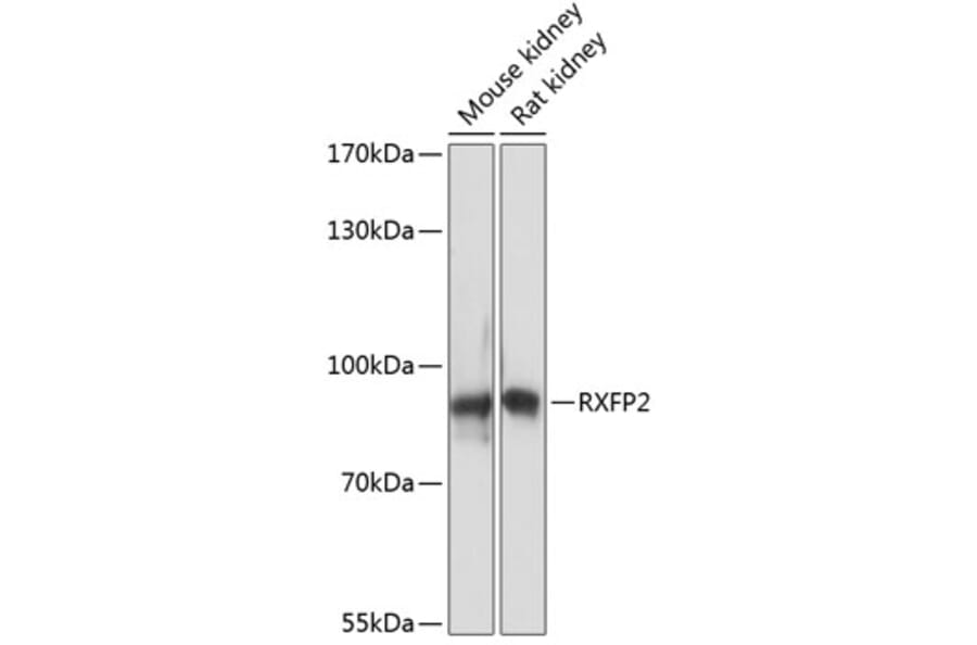 Western Blot - Anti-RXFP2 Antibody (A91395) - Antibodies.com