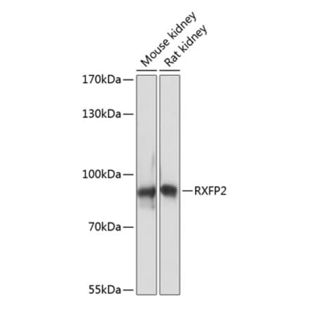 Western Blot - Anti-RXFP2 Antibody (A91395) - Antibodies.com