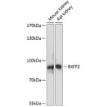 Western Blot - Anti-RXFP2 Antibody (A91395) - Antibodies.com