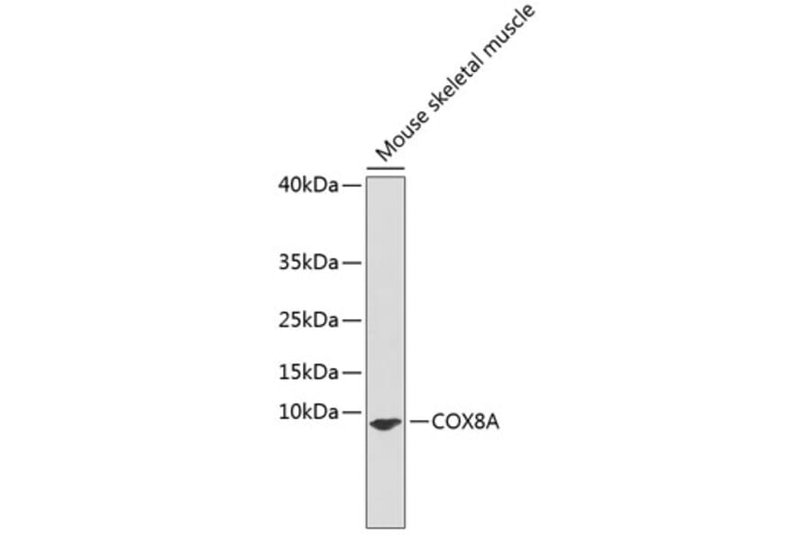 Western Blot - Anti-COX8A Antibody (A91396) - Antibodies.com