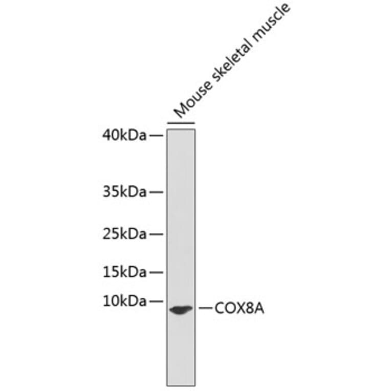 Western Blot - Anti-COX8A Antibody (A91396) - Antibodies.com