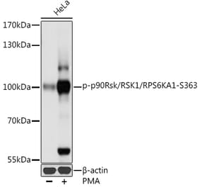 Western Blot - Anti-RSK1 p90 (phospho Ser363) Antibody (A91397) - Antibodies.com