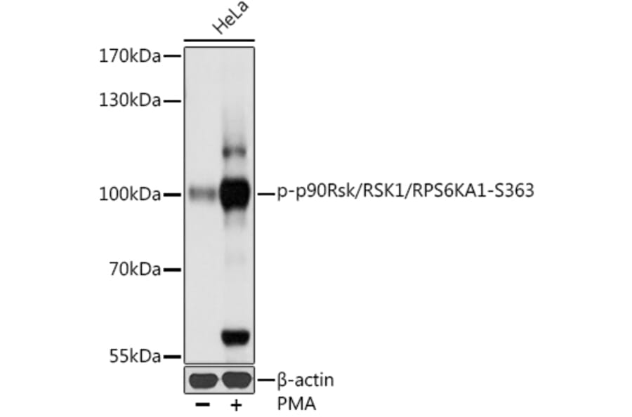 Western Blot - Anti-RSK1 p90 (phospho Ser363) Antibody (A91397) - Antibodies.com