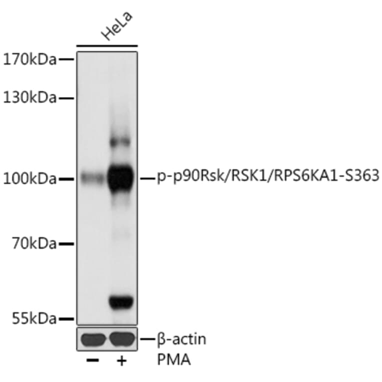 Western Blot - Anti-RSK1 p90 (phospho Ser363) Antibody (A91397) - Antibodies.com