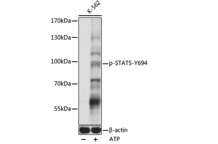 Western Blot - Anti-STAT5 (phospho Tyr694) Antibody (A91399) - Antibodies.com