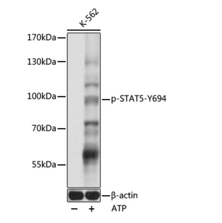 Western Blot - Anti-STAT5 (phospho Tyr694) Antibody (A91399) - Antibodies.com