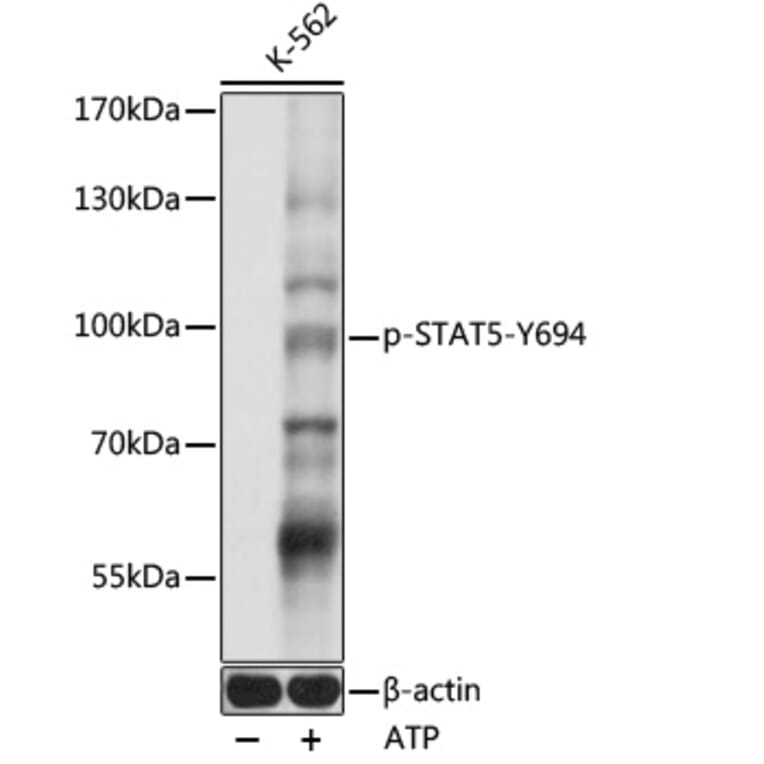 Western Blot - Anti-STAT5 (phospho Tyr694) Antibody (A91399) - Antibodies.com