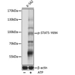 Western Blot - Anti-STAT5 (phospho Tyr694) Antibody (A91399) - Antibodies.com