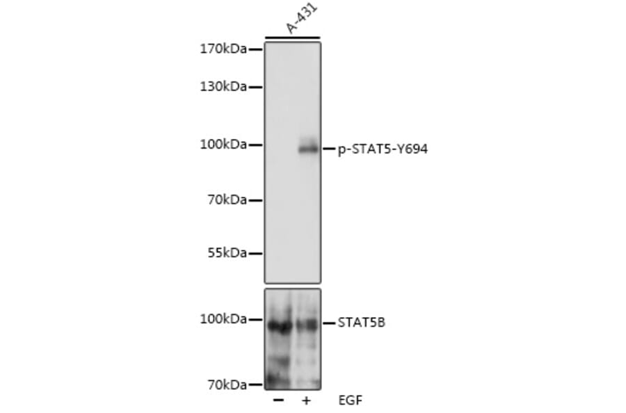 Western Blot - Anti-STAT5 (phospho Tyr694) Antibody (A91399) - Antibodies.com