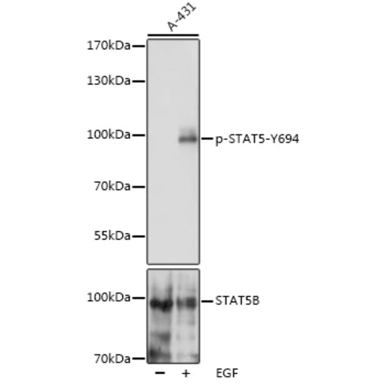 Western Blot - Anti-STAT5 (phospho Tyr694) Antibody (A91399) - Antibodies.com