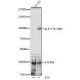 Western Blot - Anti-STAT5 (phospho Tyr694) Antibody (A91399) - Antibodies.com