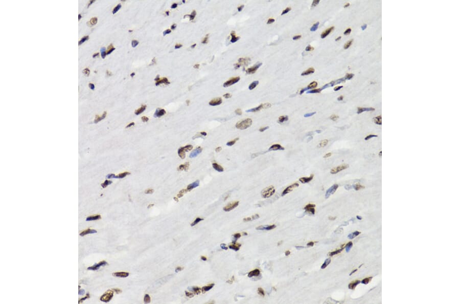 Immunohistochemistry - Anti-STAT5 (phospho Tyr694) Antibody (A91399) - Antibodies.com
