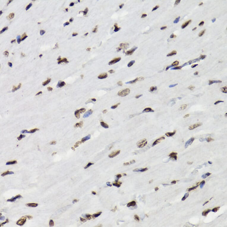 Immunohistochemistry - Anti-STAT5 (phospho Tyr694) Antibody (A91399) - Antibodies.com