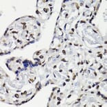 Immunohistochemistry - Anti-STAT5 (phospho Tyr694) Antibody (A91399) - Antibodies.com