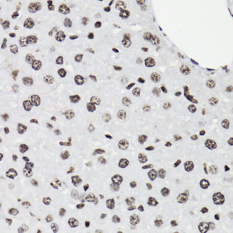 Immunohistochemistry - Anti-STAT5 (phospho Tyr694) Antibody (A91399) - Antibodies.com