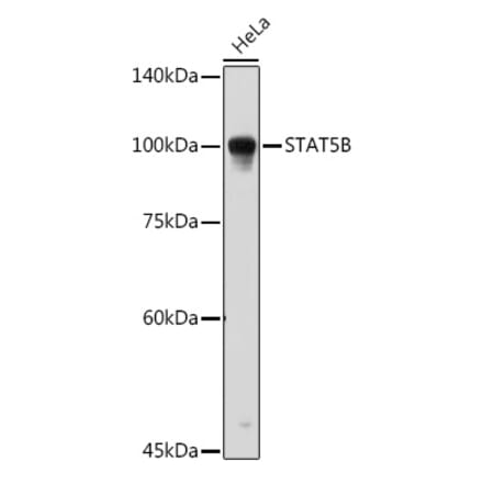 Western Blot - Anti-STAT5 Antibody (A91400) - Antibodies.com