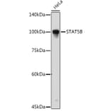 Western Blot - Anti-STAT5 Antibody (A91400) - Antibodies.com