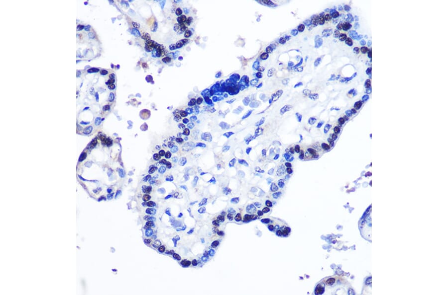 Immunohistochemistry - Anti-STAT5 Antibody (A91400) - Antibodies.com