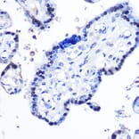 Immunohistochemistry - Anti-STAT5 Antibody (A91400) - Antibodies.com