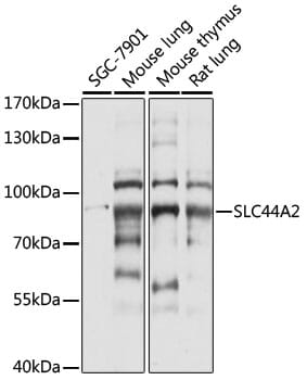 Western blot analysis of extracts of various cell lines, using Anti-SLC44A2 Antibody (A15178) at 1:1,000 dilution.
Secondary antibody: Goat Anti-Rabbit IgG (H+L) (HRP) (AS014) at 1:10,000 dilution.
Lysates / proteins: 25µg per lane.
Blocking buffer: 3% non-fat dry milk in TBST.
Detection: ECL Basic Kit (RM00020).
Exposure time: 5s.