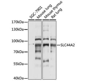 Western Blot - Anti-SLC44A2 Antibody (A91401) - Antibodies.com
