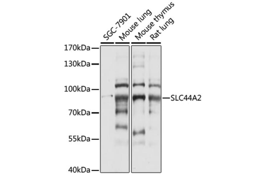 Western Blot - Anti-SLC44A2 Antibody (A91401) - Antibodies.com