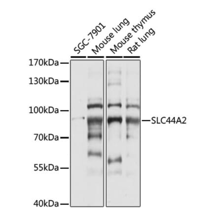 Western Blot - Anti-SLC44A2 Antibody (A91401) - Antibodies.com