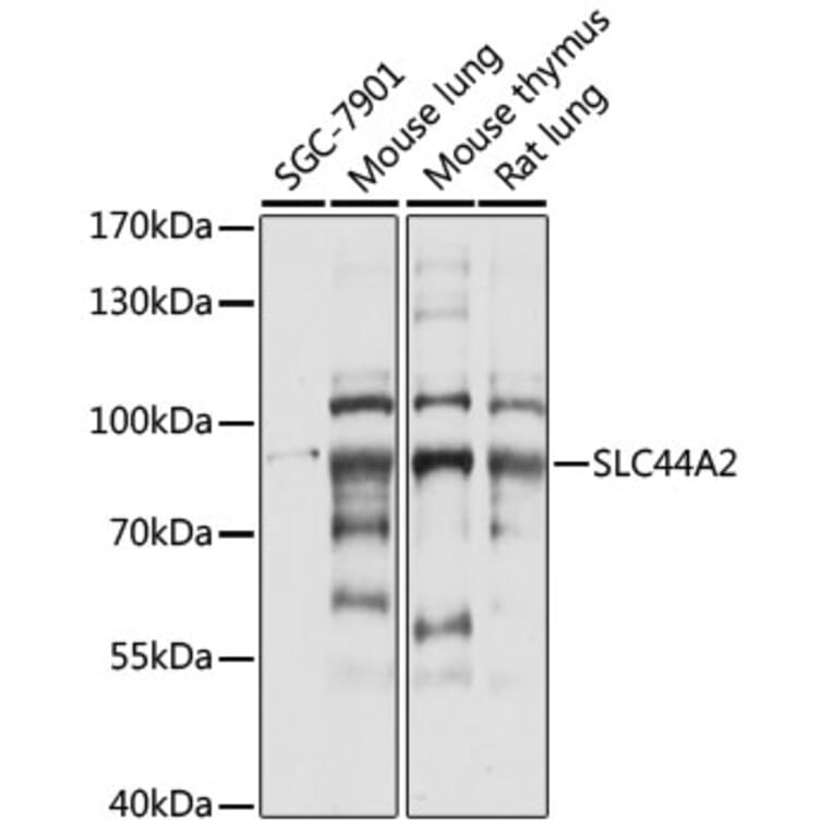 Western Blot - Anti-SLC44A2 Antibody (A91401) - Antibodies.com