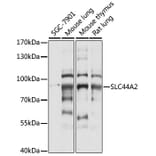 Western Blot - Anti-SLC44A2 Antibody (A91401) - Antibodies.com