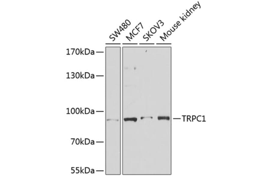 Western Blot - Anti-TRPC1 Antibody (A91402) - Antibodies.com