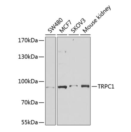 Western Blot - Anti-TRPC1 Antibody (A91402) - Antibodies.com