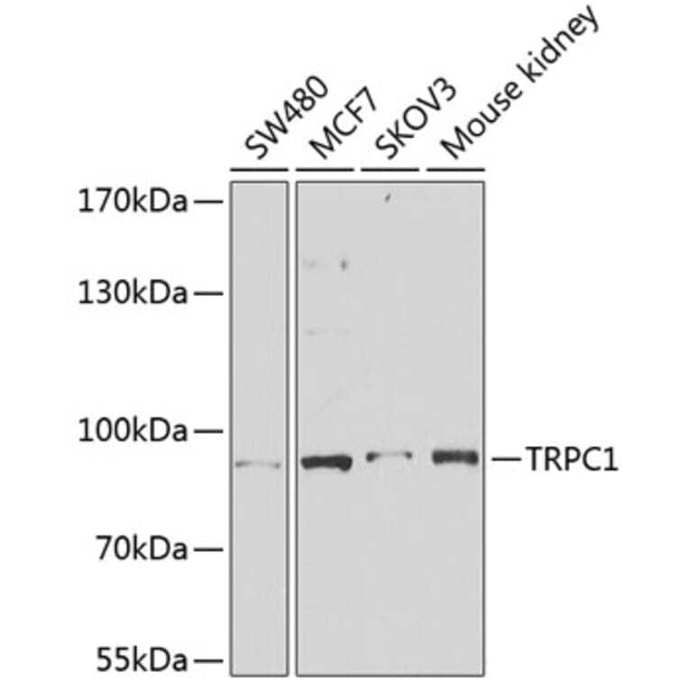 Western Blot - Anti-TRPC1 Antibody (A91402) - Antibodies.com