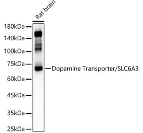 Western Blot - Anti-Dopamine Transporter Antibody (A91403) - Antibodies.com