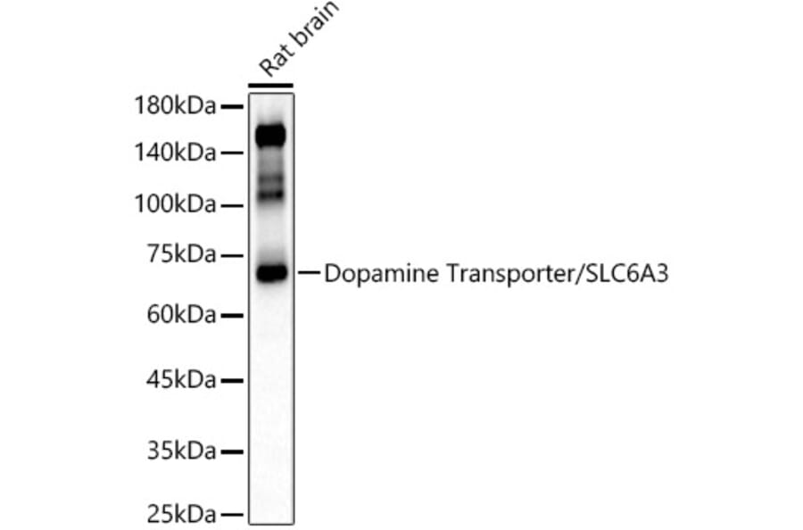 Western Blot - Anti-Dopamine Transporter Antibody (A91403) - Antibodies.com
