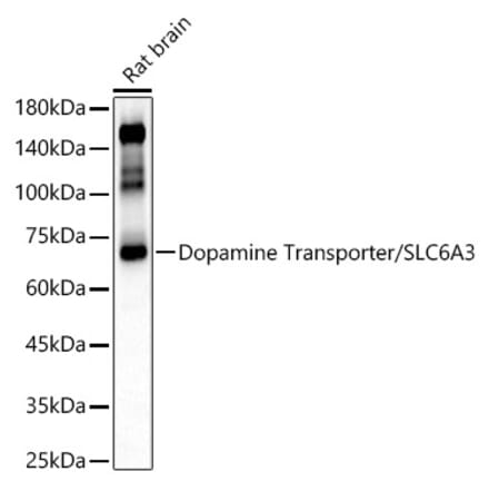 Western Blot - Anti-Dopamine Transporter Antibody (A91403) - Antibodies.com
