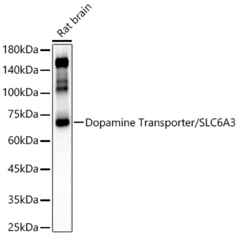 Western Blot - Anti-Dopamine Transporter Antibody (A91403) - Antibodies.com