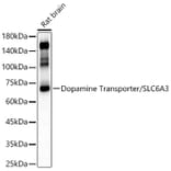 Western Blot - Anti-Dopamine Transporter Antibody (A91403) - Antibodies.com