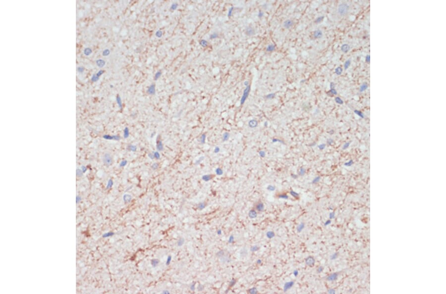 Immunohistochemistry - Anti-Dopamine Transporter Antibody (A91403) - Antibodies.com